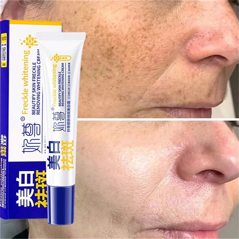 Potente crema sbiancante per l - Skincare Korea recensione e prezzo
