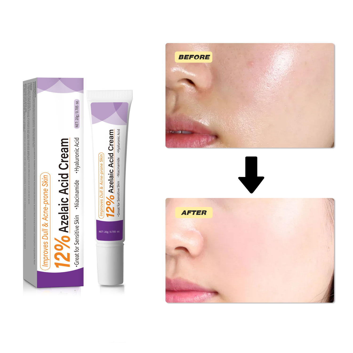 Crema all'Acido Azelaico Delic - Skincare Skintific recensione e prezzo